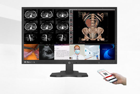 医用影像专业显示器